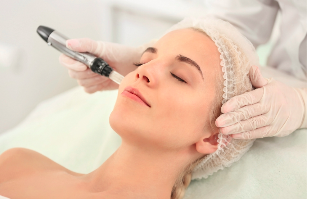 Read more about the article Micro Needling: Don’t Be Scared!