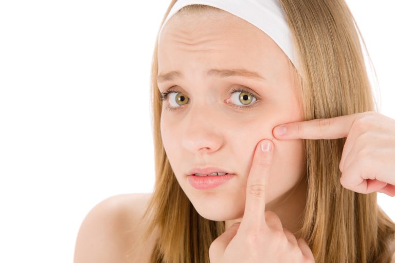 Teens, Acne and the Mask